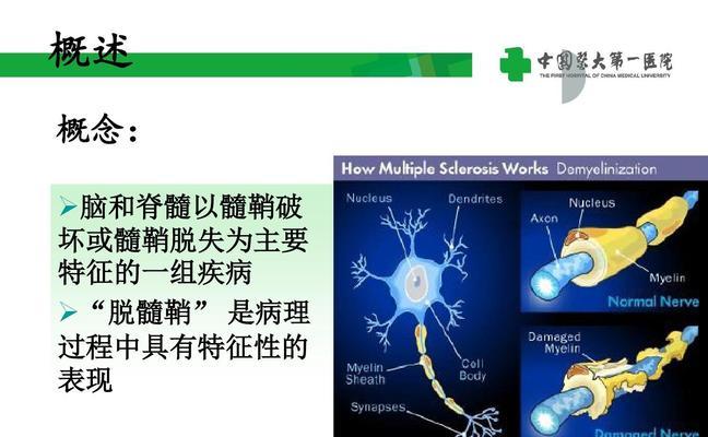 《挑战人体工厂中枢神经通关技巧》（以游戏为主，让你轻松掌握中枢神经解密技能！）