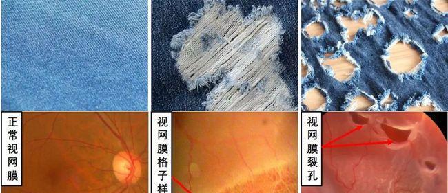 玩转人体工厂——视网膜成像通关技巧（探索视网膜成像秘密，解锁无限游戏乐趣！）
