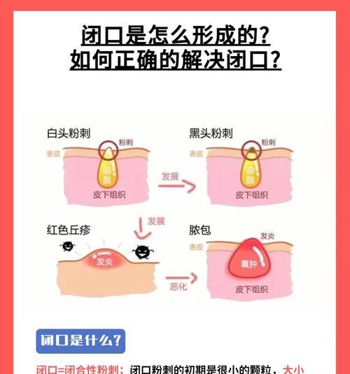 DNF天界闭口问题如何解决？闭口的正确打法是什么？
