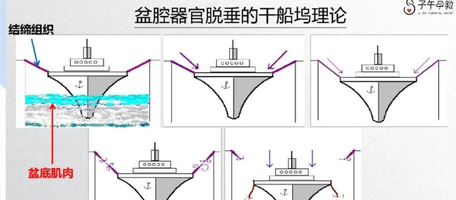 干船坞配件使用技巧是什么？如何提升效率？